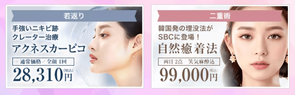 sbc33